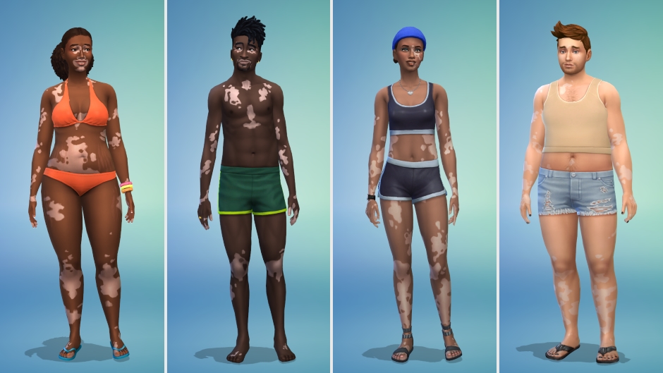 Die Sims 4 - Vitiligo